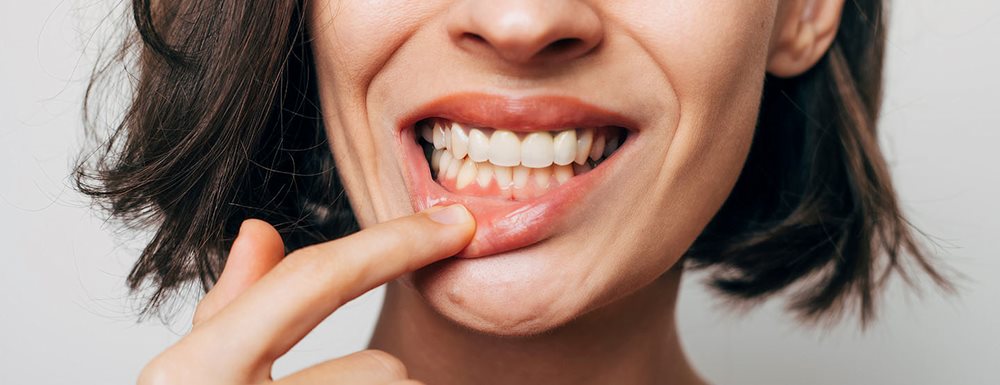 Krvarenje zubnog mesa: stomatolozi ističu sljedeće uzroke