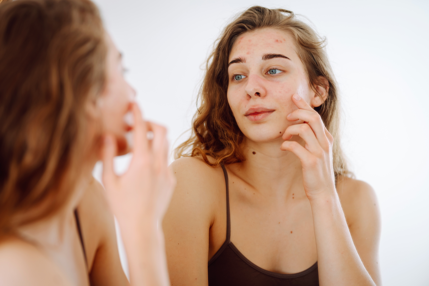 Maligni melanom: prevencija, samopregled i značaj kreme za sunčanje!